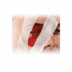 Polycarbonate Eye Shield (PES)