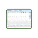 Doppler Signals Analysis Software